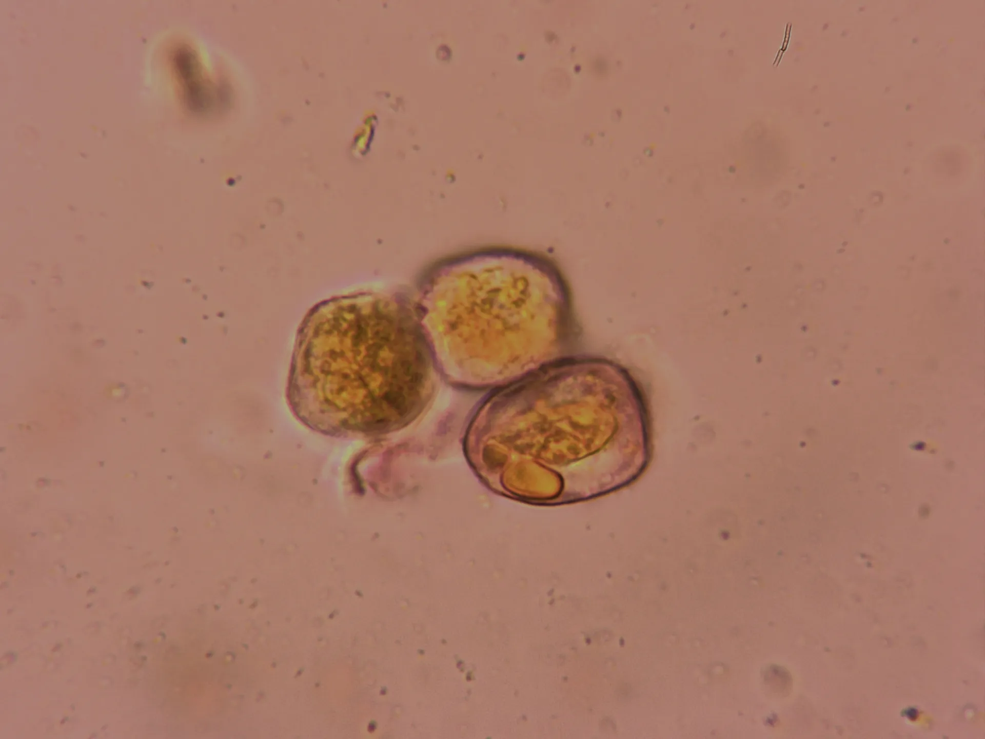 Microscopía de Puccinia coronata - 11 eciosporas